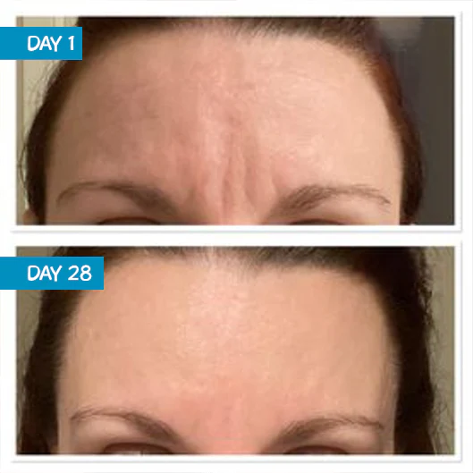 Amplified Anti-Aging Peptide Active Serum with Argireline® 25ml - Image 3