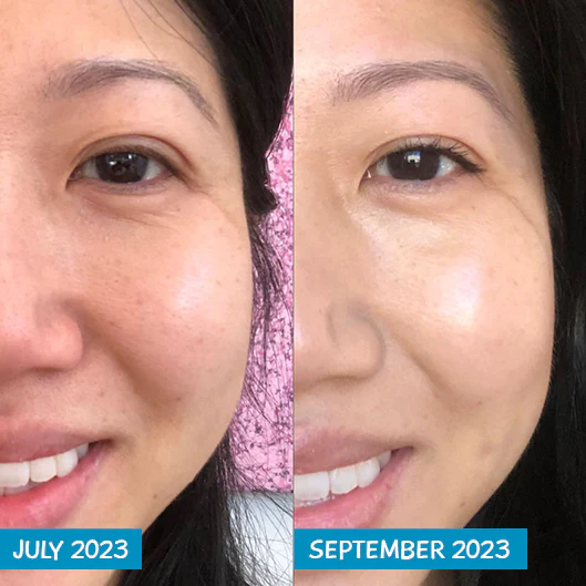 Amplified Anti-Aging Peptide Active Serum with Argireline® 25ml - Image 7