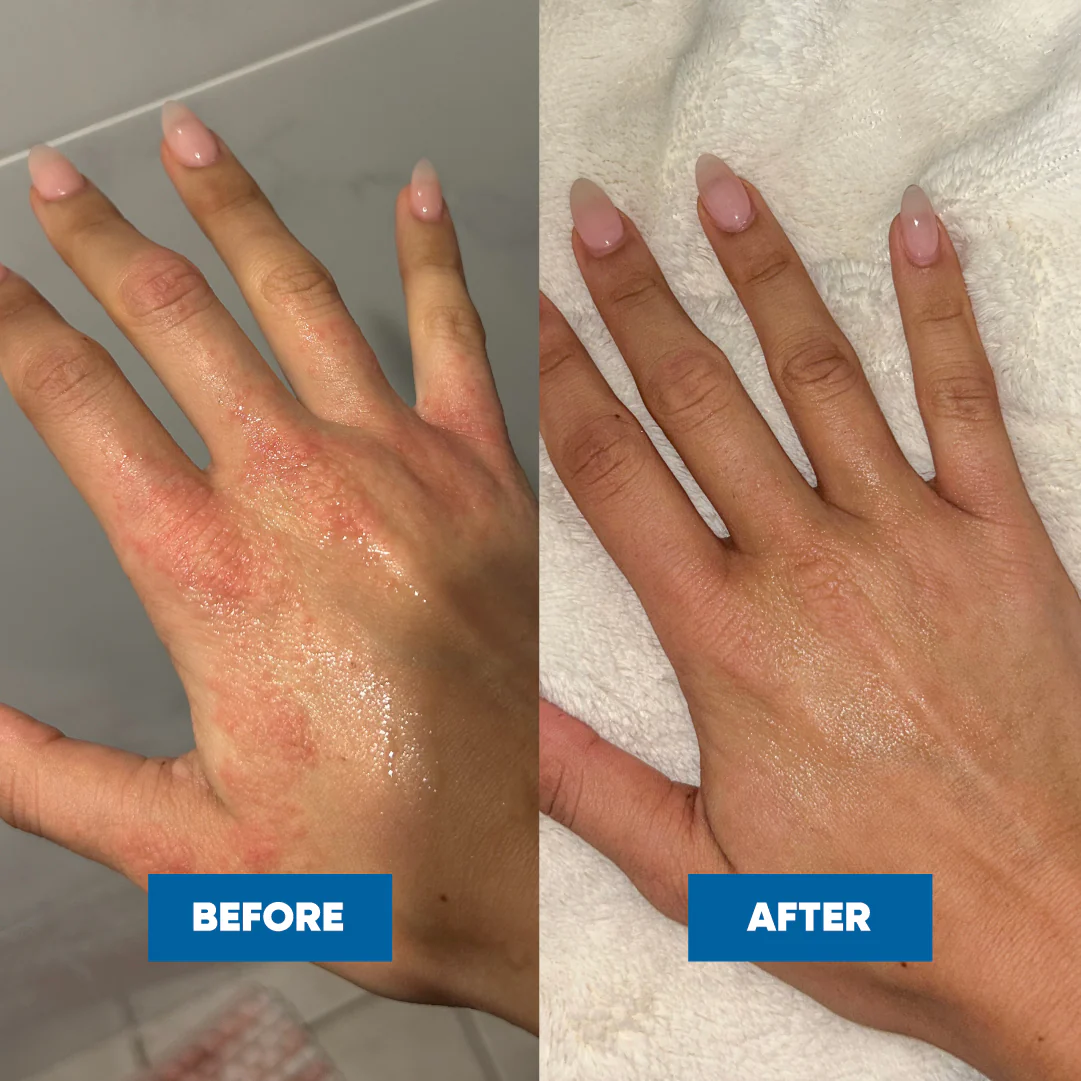 Scalp Repair Cream 120g - Image 3